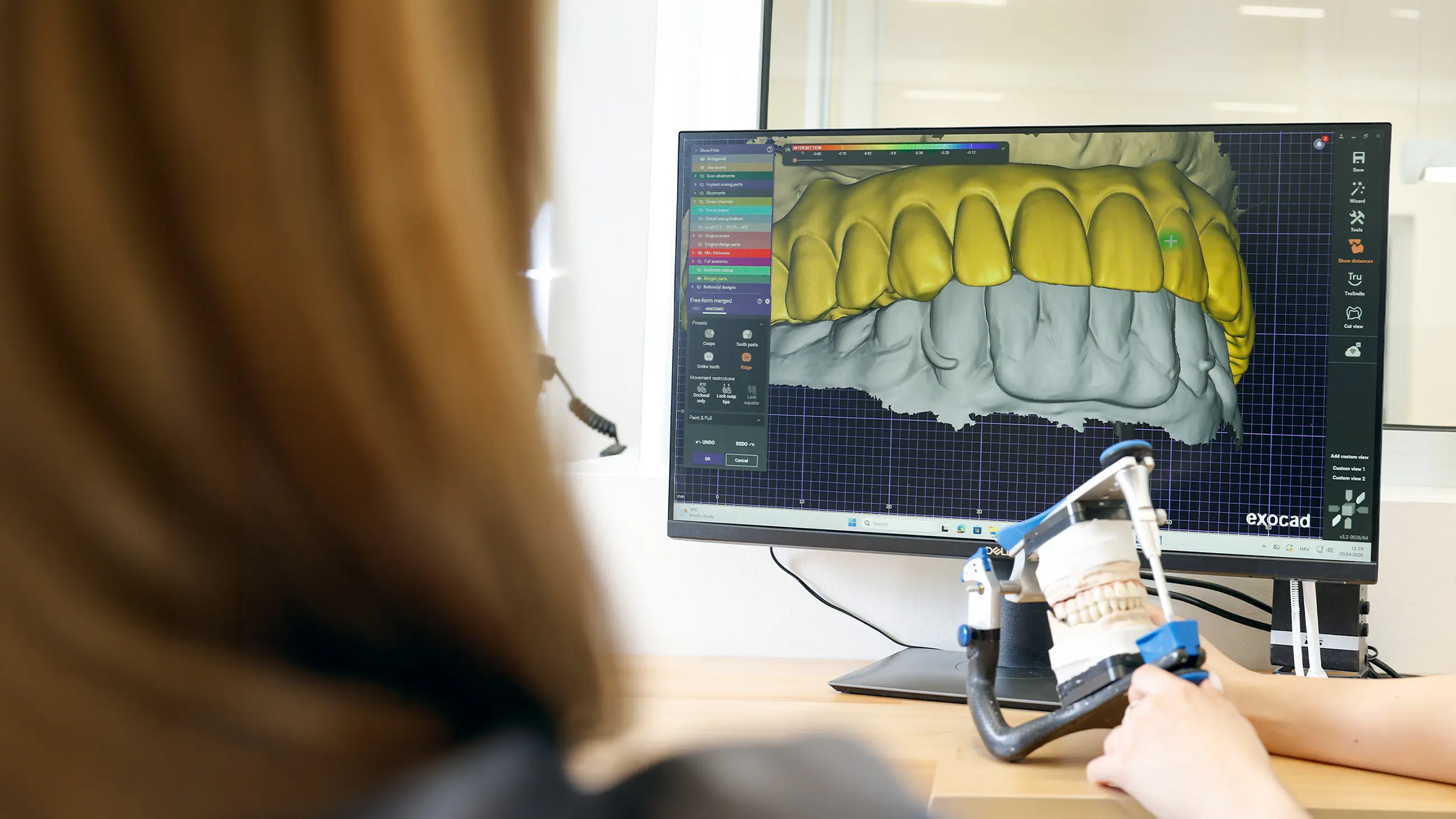 Pianificazione digitale di una protesi dentale nel laboratorio DentVitalis
